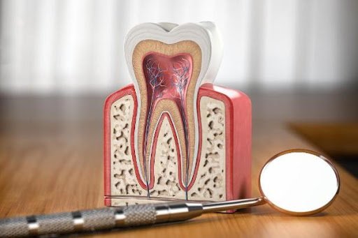 Understanding Impacted Wisdom Teeth and Their Treatment Options