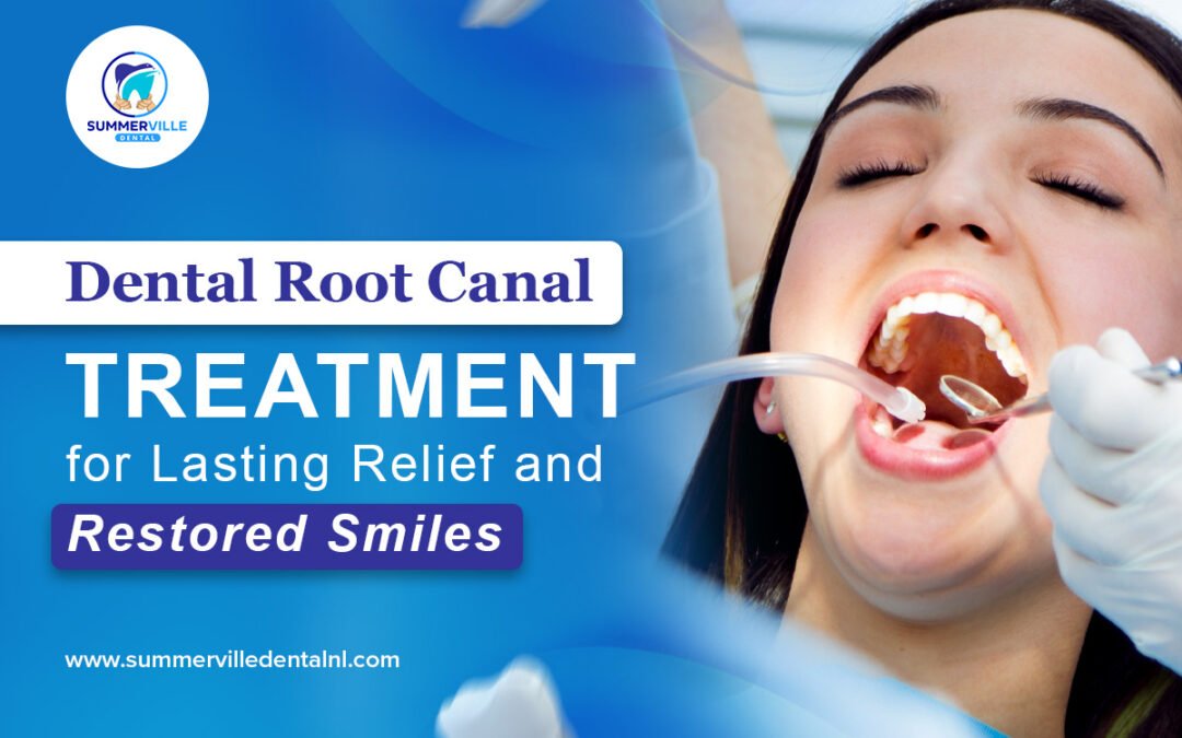 Dental root canal treatment for lasting relief and restored smiles