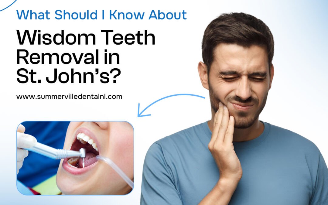 What Should I Know About Wisdom Teeth Removal in St. John’s?